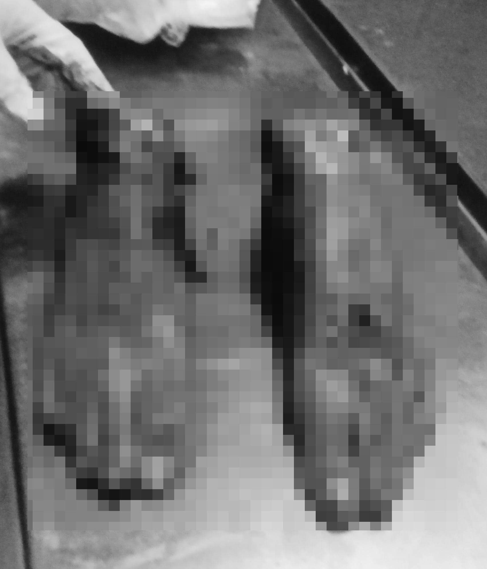 Utod nga tiil sang tawo nasapwan sa kilid sang dalan sa Bacolod City