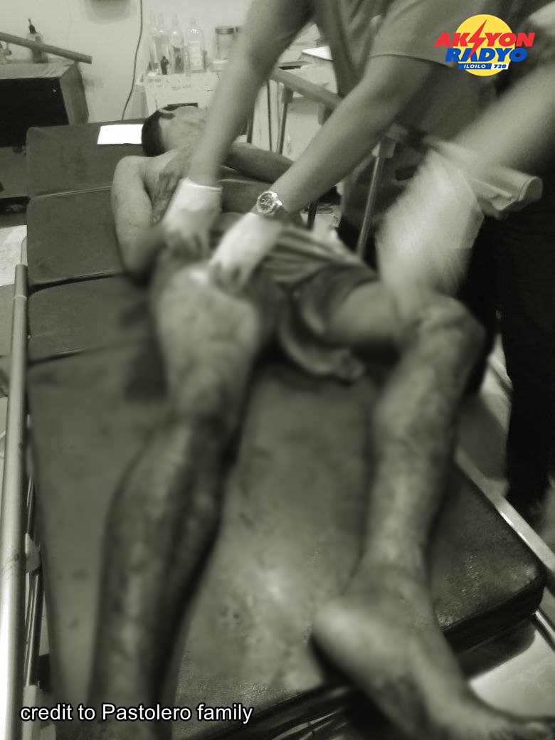 Lalaki patay sang ginbuno sang pangayaw sa Lambunao