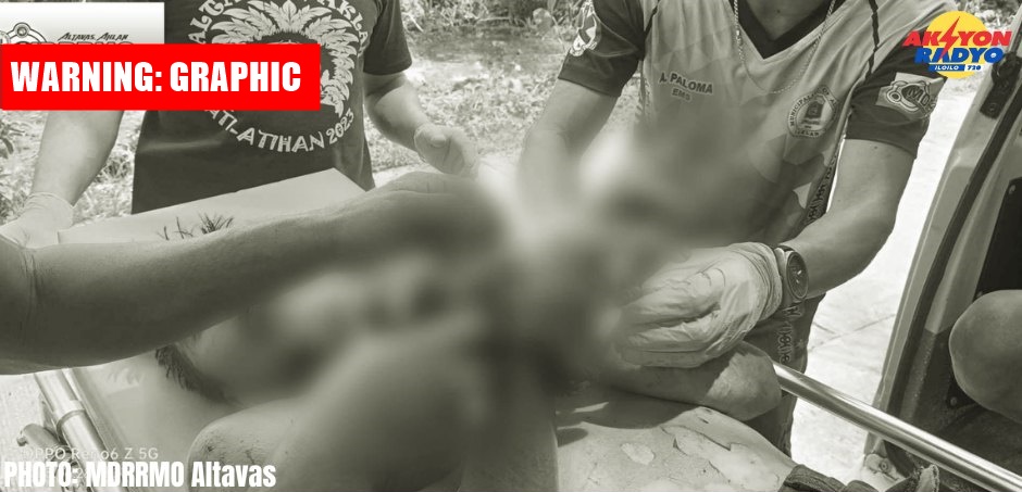 40-anyos nga lalaki sa Altavas, Aklan na-ospital sang gin-utod niya ang iya mga tudlo sa kamot kag kinatawo