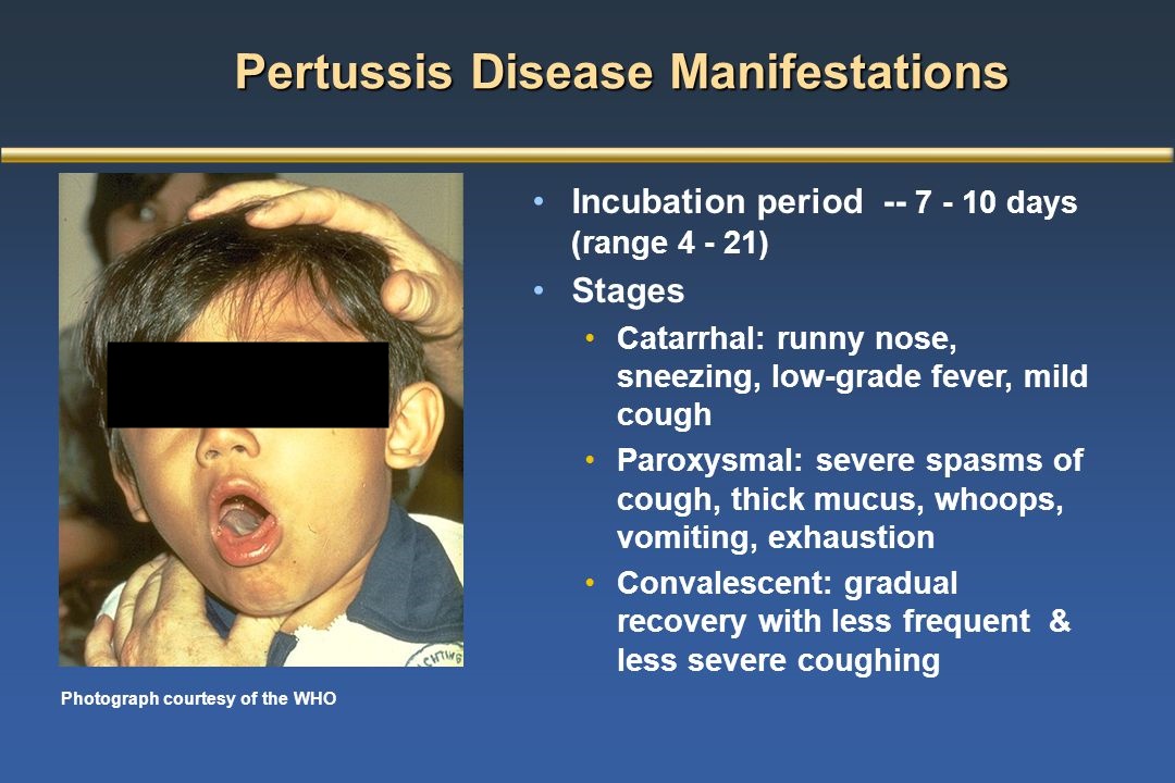 Iloilo province nagapanguna sa may pinakamadamo nga pertussis cases sa Western Visayas — DOH 6