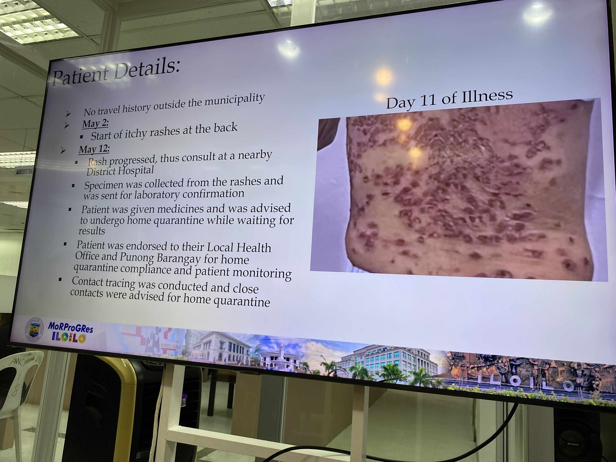 Iloilo Provincial Health Office may ginalantaw nga rason kon paano na-infect sang mpox ang pasyente sa probinsiya