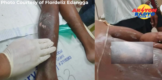 Panday, pilason sang nakuryente sa Dumangas