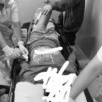 Bana pilason sang ginlabo sang iya asawa sa Miagao; asawa una nga gilampusan sang sanga sang kahoy sang iya bana