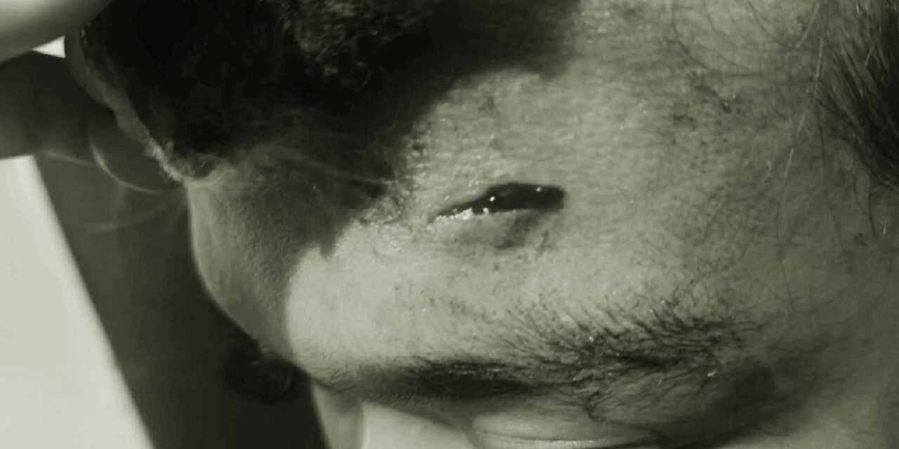 Kasing-Kasing, Molo PB Gemma Calzado ginpreso sang ginreklamo nga nanglampos sa SK Kagawad; FB posts sang tagreklamo ginatudlo rason sang insidente