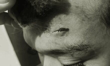 Kasing-Kasing, Molo PB Gemma Calzado ginpreso sang ginreklamo nga nanglampos sa SK Kagawad; FB posts sang tagreklamo ginatudlo rason sang insidente