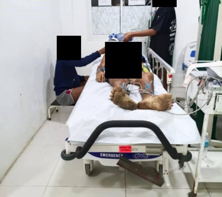 Mag-asawa patay sang ginbuno sang ila bata nga may deperensiya sa paminsaron sa Passi City