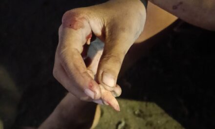 Solterito nga nanghaboy sang bato sa mga nagabantay sang jeep sa Ledesma St., City Proper nakakas ang unto sang nakamumo sa center island samtang nagapalagyo sa mga naglagas sa iya